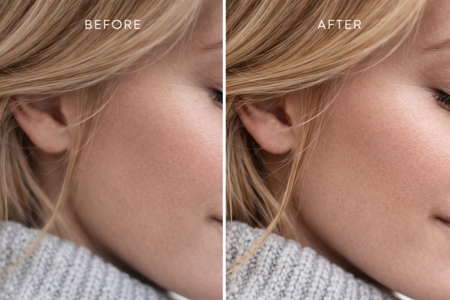Skin Image Restoration
